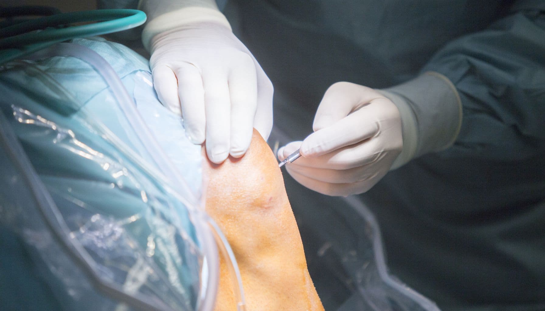 Orthopedics (Bone & Joint)